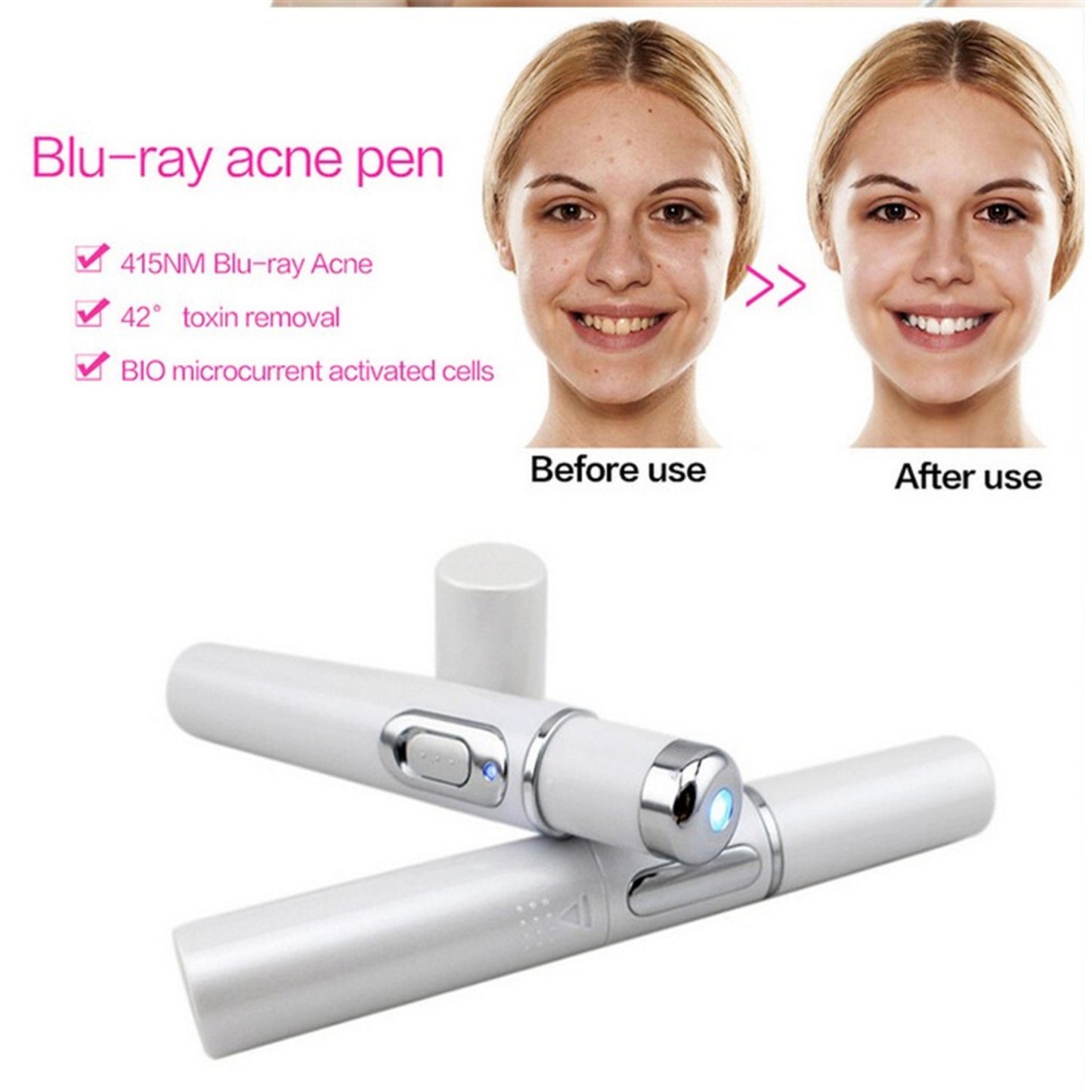 Stylo Laser Anti-Acné & Soin de la Peau