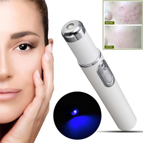 Stylo Laser Anti-Acné & Soin de la Peau